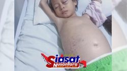 Nursaidah 6 Tahun Butuh Uluran Tangan Dermawan, Alami Kanker Darah Harus Butuh Darah B+